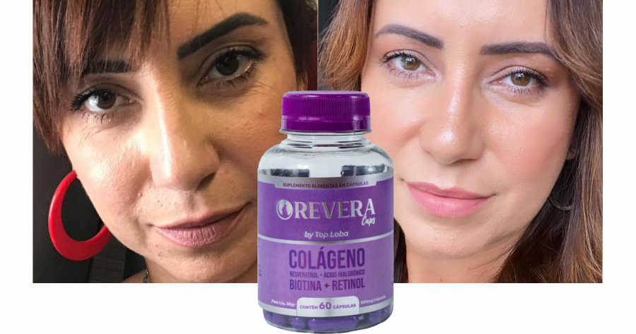 Revera Caps-Bom para a pele